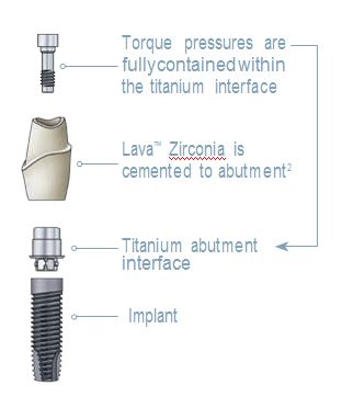 zirconia tooth